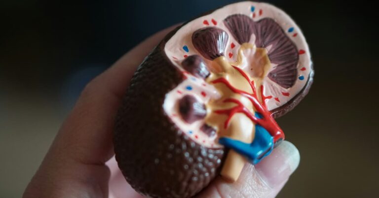 Ultimate Guide: How to Pass a Kidney Stone in 24 Hours