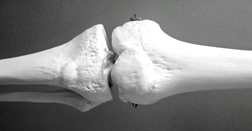 Estradiol in bone health Estradiol in bone health