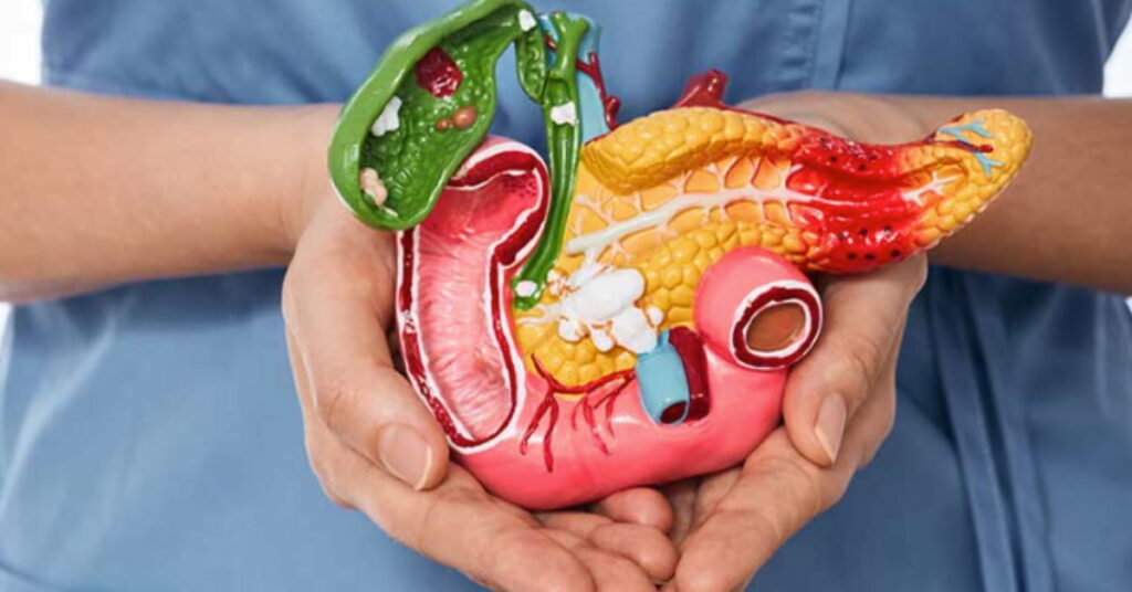 How to Keep Your Pancreas Healthy How to Keep Your Pancreas Healthy