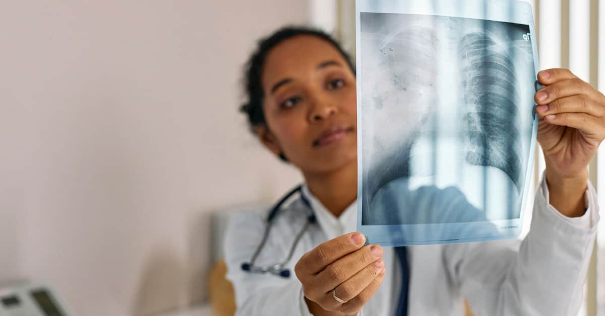 Is Pneumonia Contagious? Types Of Pneumonia, Powerful Vaccine and 9 Supportive Therapy