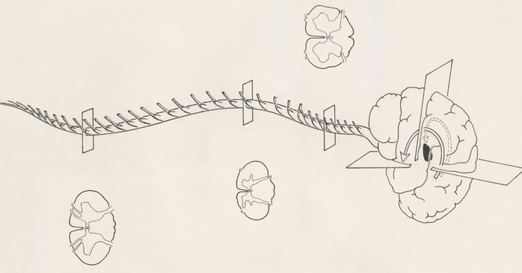 The Central Nervous System (CNS) The Central Nervous System (CNS)